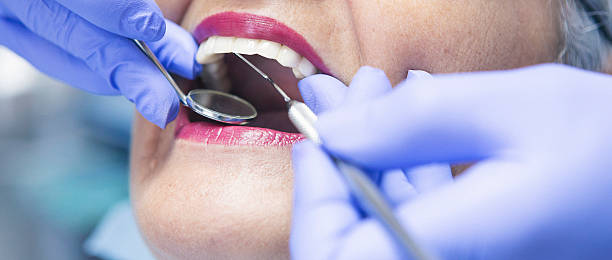 Best Emergency Care for Gum Disease in St Rose, LA
